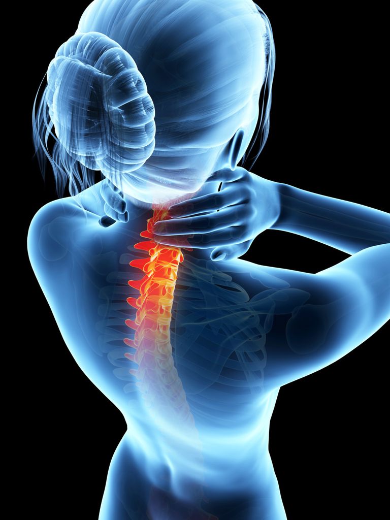 Reumatoid artrit, strålar eller, drabbade området, drabbade området ryggraden, eller båda, området ryggraden