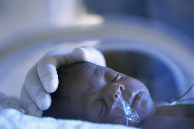 prematura barn, efter födseln, kronisk lungsjukdom