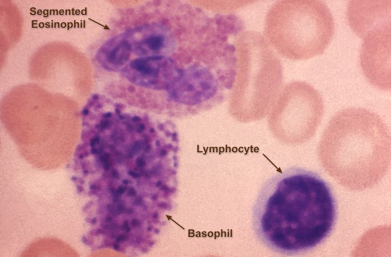 röda blodkroppar, antal röda, antal röda blodkroppar, andra test, blodceller räkning