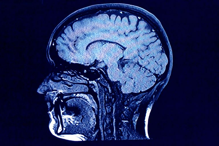 delar hjärnan, faktiskt vara, mediala prefrontala, mediala prefrontala cortexen, mediala temporala, mediala temporala loben