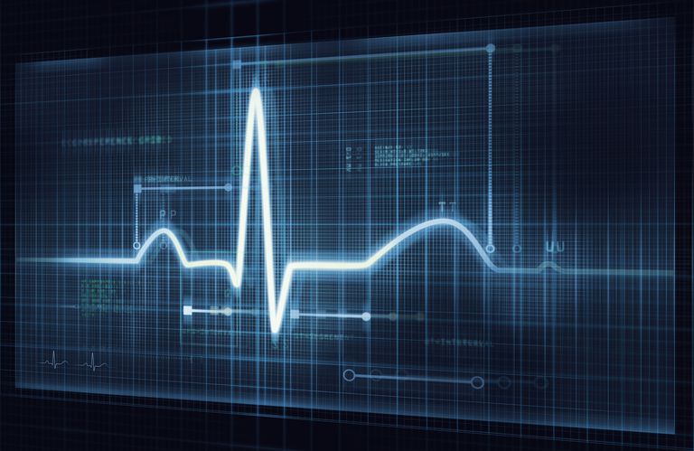ambulatorisk övervakning, dina symtom, letar efter, medicinska historia, underliggande hjärtsjukdom