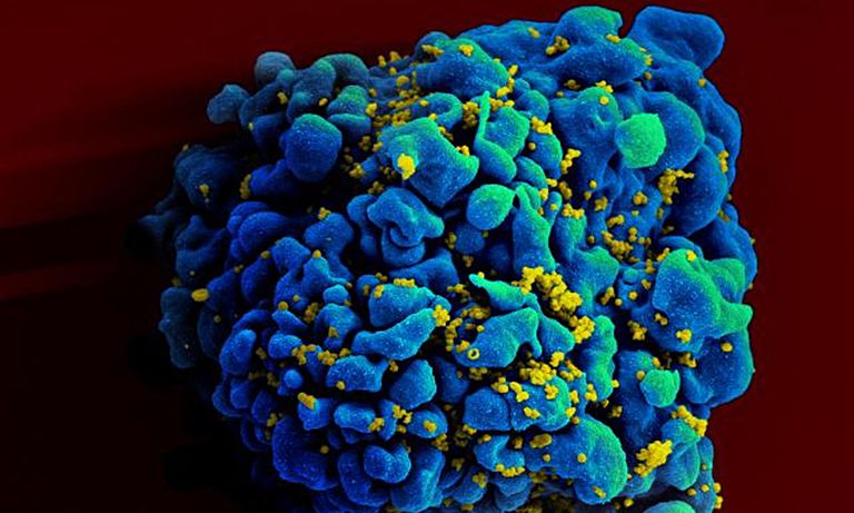 HIV-1-grupp HIV-1-grupp, andel infektioner, bland mindre, bland mindre andel, hela världen, HIV-1 HIV-2