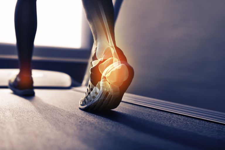 Achilles tendonit, Detta resulterar, överanvändningsskada uppstår, skada viktigt