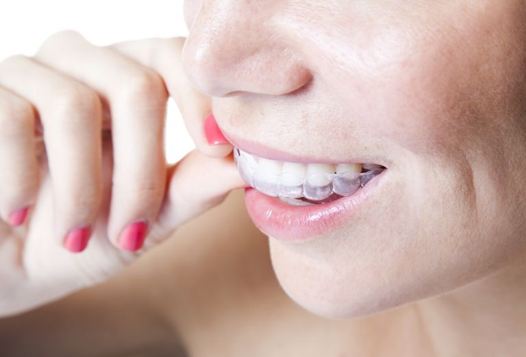 dina tänder, Invisalign hållare, Invisalign Retainer, varmt eller, eller varmt