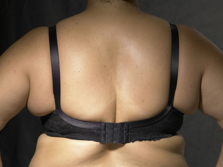överskott fett, Bulge Reason, problemet överflödigt, dåligt passande
