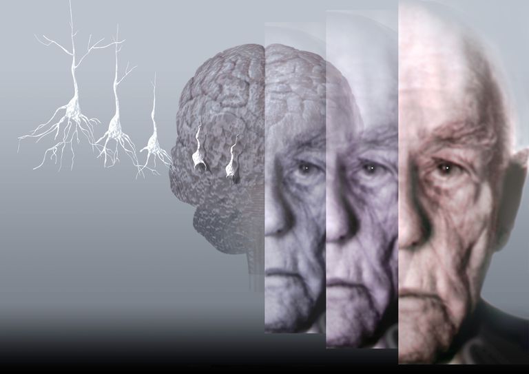 Alzheimers sjukdom, utmanande beteenden, eller förhindra, A-B-C-beteendekedjan A-B-C-beteendekedjan, acceptera förhållandet