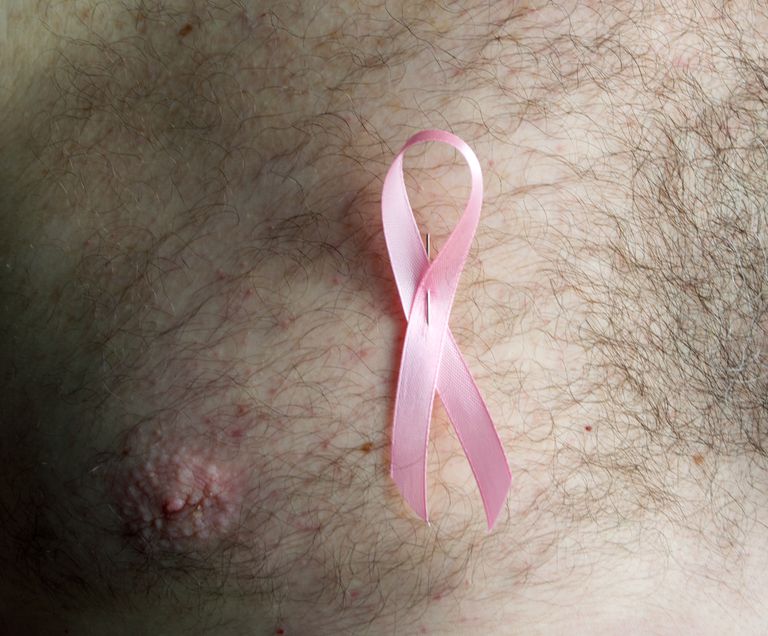 manlig bröstcancer, Klinefelters syndrom, Pagets sjukdom, American Cancer, American Cancer Society, både kvinnor
