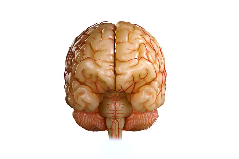 tredje ventrikeln, efter huvudtrauma, hjärnan från, hjärnans mitt, Midline Shift, mittlinjeförskjutning inträffar