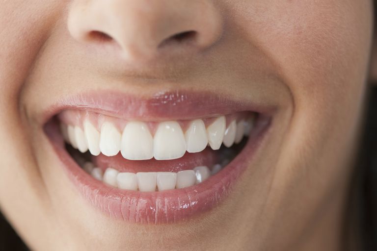 ditt leende, dina tänder, finns många, Kosmetisk tandvård Alternativ, tandvård Alternativ, förbättra ditt
