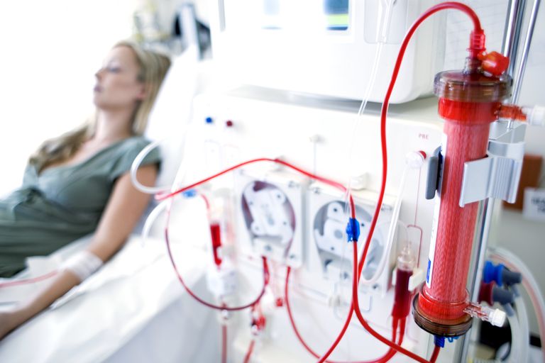 blod från, dialys dialys, denna anslutning, dessa funktioner, dessa komplikationer, dialys sjuksköterska