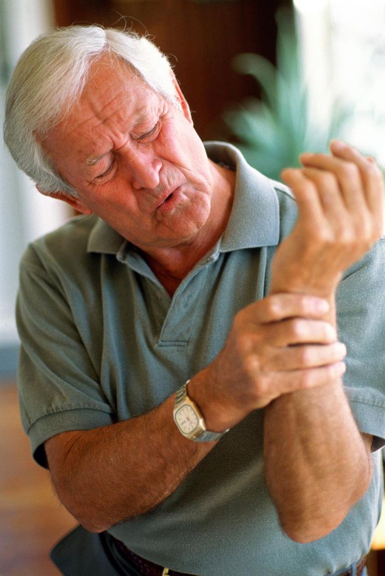 Colles fraktur, fysisk terapi, hand handled, handled eller, smärta svullnad, använda hand