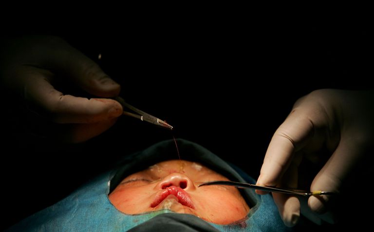 Kosmetisk kirurgi