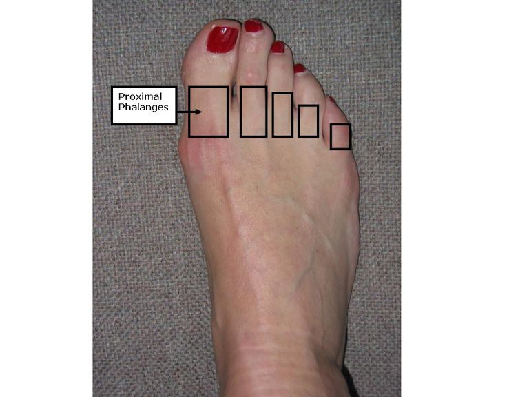 proximala falangerna, proximala phalanx, anatomi fötterna, förbinder mellanliggande