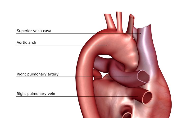 vårt hjärta, högt blodtryck, artärerna runt, båda sidor, blod lungorna