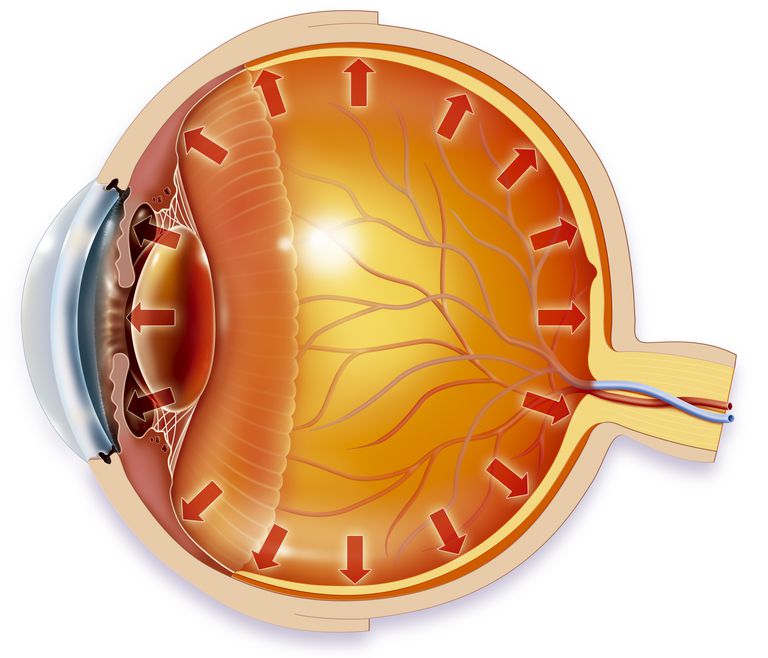 efter operationen, aktuella ögondroppar, förhindra infektion, inte sänker