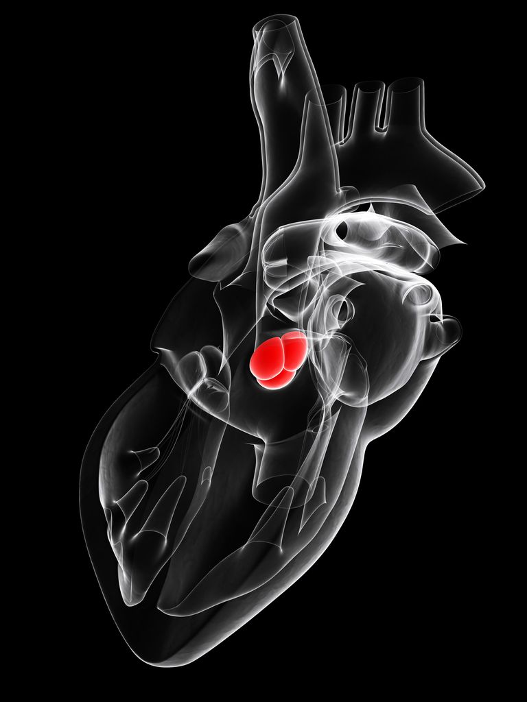 öppen hjärtkirurgi, allvarlig aortastensos, aortisk upprepning, behandling vissa, betydande risker