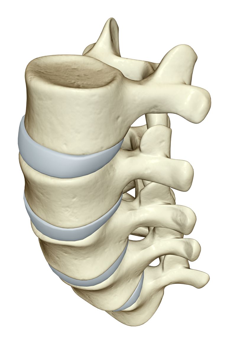 tvärgående processer, hernierad skiva, ryggen ryggkroppen, benbenet ryggen, diskuterats ovan