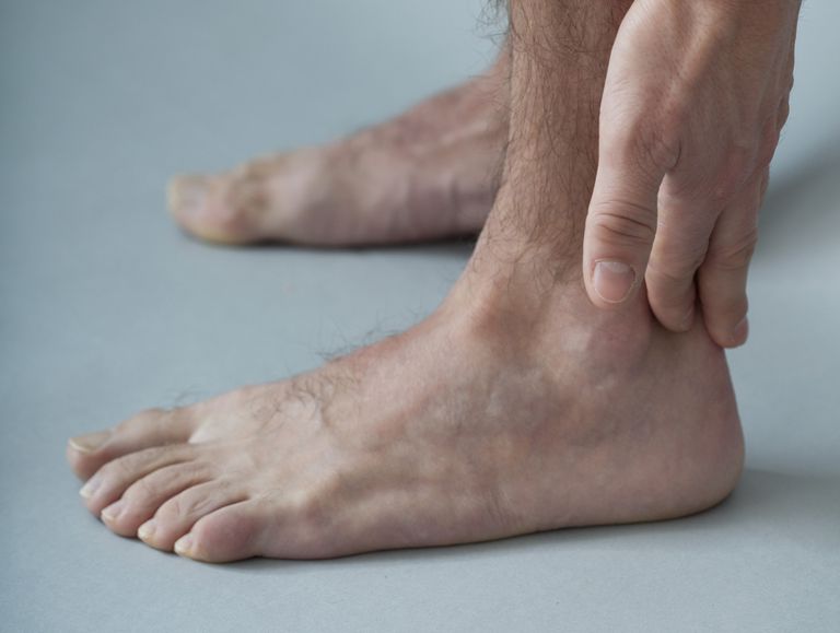 tibial tendonit, aktivitet eller, bakre tibial, bakre tibial tendonit, baksidan fotleden, drabbade senan