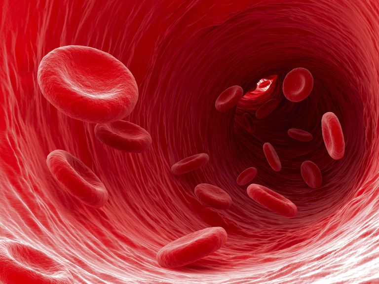 polycytemi Vera, röda blodkroppar, detta tillstånd, denna sjukdom