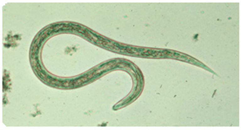 celiac sjukdom, hookworm larver, Cook University, hookworms konsumerade, hookworms visar