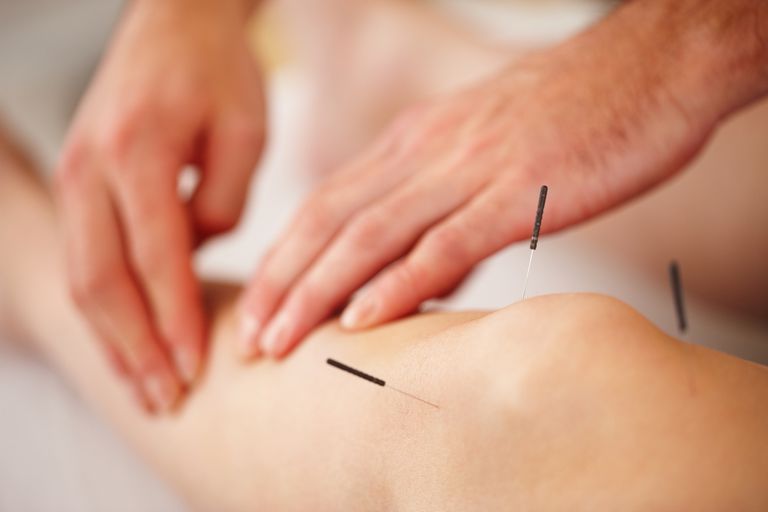 akupunktur fungerar, Akupunktur sägs, även känd, blödning eller