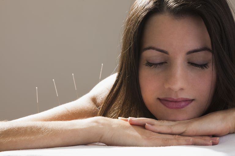 både väst, fungerar akupunktur, kommer akupunktören, potentiella fördelarna