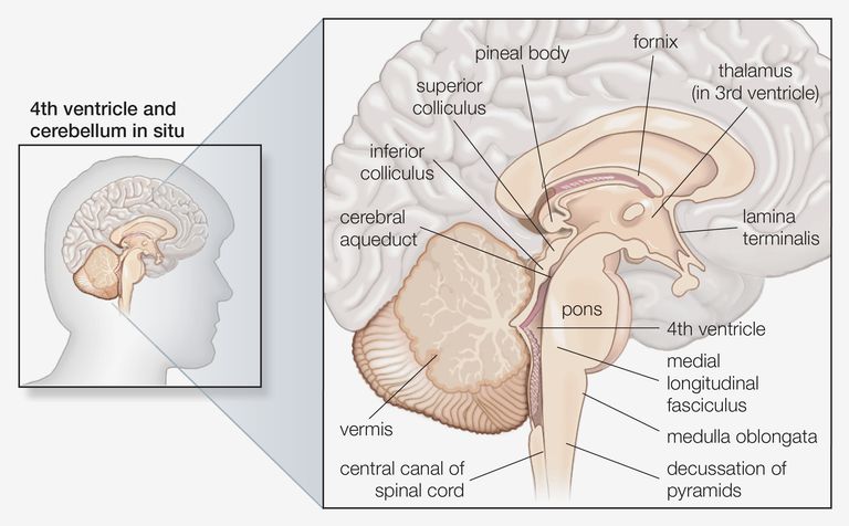 medullary stroke, medulla oblongata, stroke medulla oblongata, andra stroke, ansikte eller, ansikte eller sidan