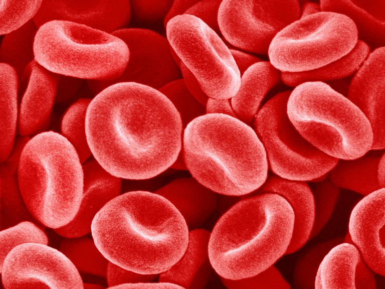 hemolytisk anemi, röda blodkroppen, eller livsmedel, måste läkare, mediciner eller, mediciner eller livsmedel