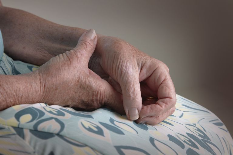 benen handleden, handleden artrit, bland vanligaste, från ledgångsartrit, Handled artrit, Handled instabilitet